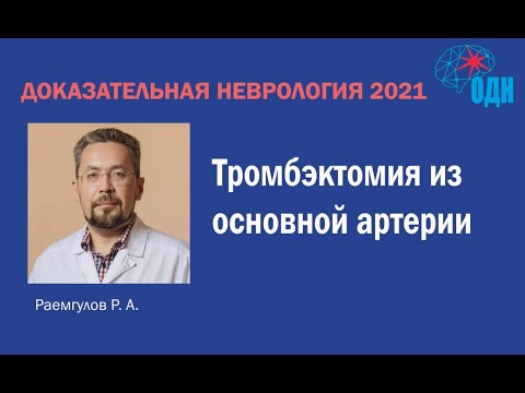 Видео: Тромбэктомия из основной артерии