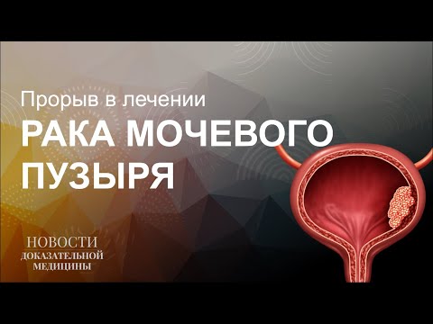 Видео: Рак мочевого пузыря. Новости.