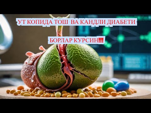 Видео: УТ-ТОШ  КАСАЛЛИГИ (ЖКБ) ВА КАНДЛИ ДИАБЕТ / ДИАБЕТ ВА ДИЕТА / ДИАБЕТНИ ДАВОЛАШ / 974343536 - ТЕЛЕГРАМ