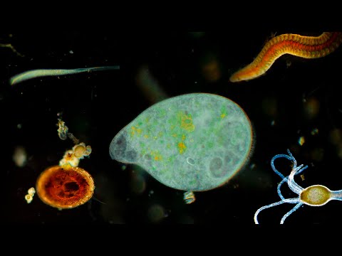 Видео: ЧТО МОЖНО УВИДЕТЬ В КАПЛЕ ВОДЫ С ГОРОДСКОГО ОЗЕРА ПОД МИКРОСКОПОМ ЗА 1000$?