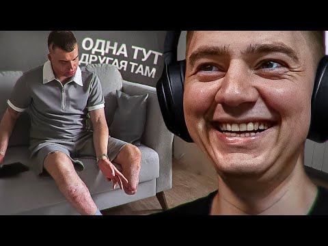 Видео: Славик угарает с оккупанта-инвалида без ноги