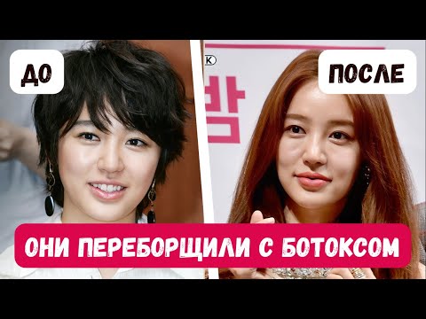 Видео: Корейские актрисы, которых вы больше не узнаете! Самая скандальная пластика в корейском шоу-бизнесе!