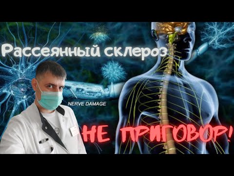 Видео: Рассеянный склероз, виды, симптомы, лечение