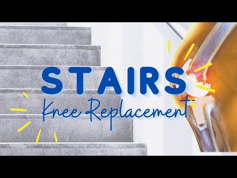 Видео: Как ходить по лестнице и почему это больно? Идеи упражнений, которые помогут: полная замена колен...