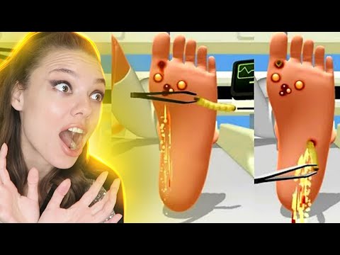 Видео: ЭТО ВЫЛЕЗЛО ИЗ НОГИ! - Doctor help