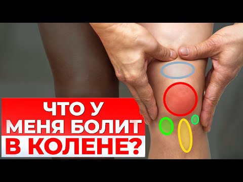 Видео: Здоровые колени без боли – ПРОСТО! / Почему болят суставы и как это исправить в домашних условиях?