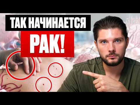 Видео: ТВОЕ ТЕЛО КРИЧИТ О ПОМОЩИ! 10 скрытых сигналов рака, которые вы игнорируете