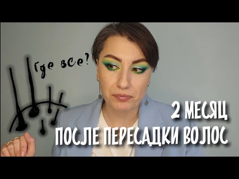 Видео: #Волосатыеистрии ВТОРОЙ МЕСЯЦ после пересадки волос |трансплантация у женщин|Алопеция