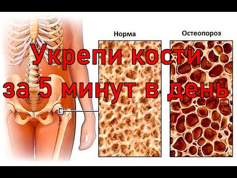 Видео: 5 минут против остеопороза – полный комплекс упражнений для укрепления костной ткани
