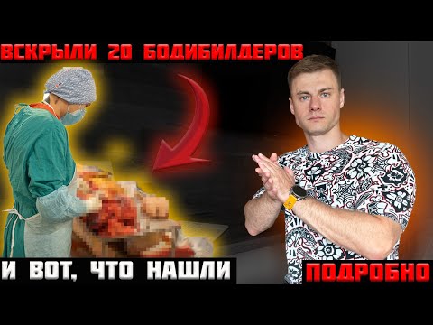 Видео: Вскрыли 20 бодибилдеров и...вот, что нашли. Подробный разбор!