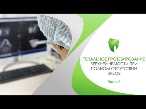 Видео: Тотальное протезирование верхней челюсти при полном отсутствии зубов. Часть 1