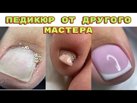 Видео: Педикюр от другого мастера 🤔 Секреты быстрого френча / Как вычистить птеригий