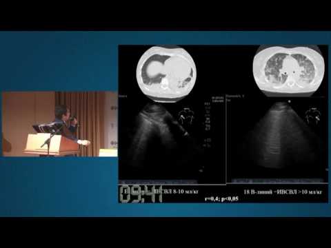 Видео: УЗИ легких при пневмониях. Новиков В.А.