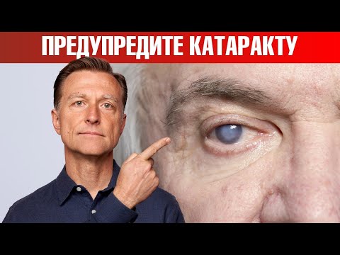 Видео: Катаракта глаза: причины и профилактика катаракты🧐