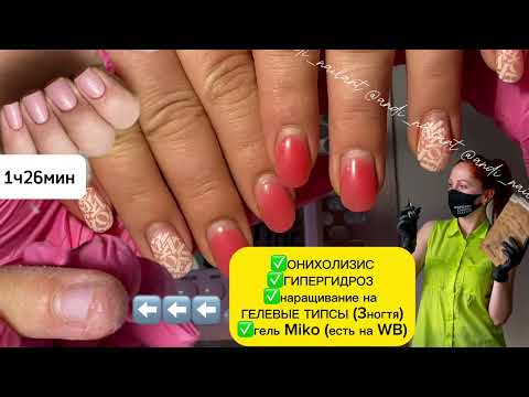 Видео: ГИПЕРГИДРОЗНЫЕ ручки, ОНИХОЛИЗИС, НАРАЩИВАНИЕ на ГЕЛЕВЫЕ ТИПСЫ. Сложная коррекция на влажных ручках