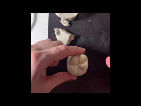 Видео: Первы моляр н/ч (2)