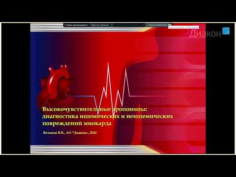 Видео: Высокочувствительные тропонины: диагностика ишемических и неишемических повреждений миокарда