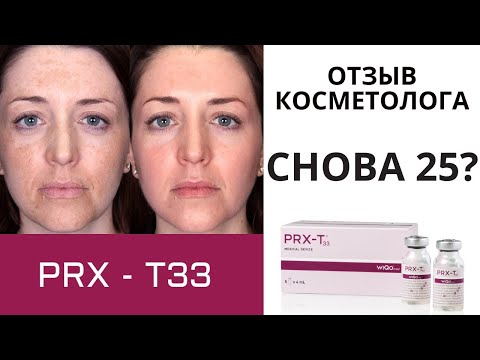 Видео: Как делают PRX-T33 пилинг лица. Отзыв врача