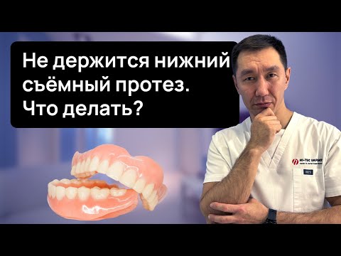Видео: НЕ ДЕРЖИТСЯ НИЖНИЙ полный ПРОТЕЗ, что делать? Расскажем как сделать так, чтобы он не выпадывал