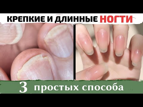 Видео: КАК ВЫЛЕЧИТЬ ГРИБОК НОГТЕЙ? Быстро отрастить ногти! Как сделать ногти КРЕПКИМИ?