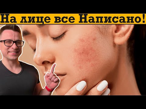 Видео: Твое лицо и кожа расскажут, о всех внутренних болезнях!