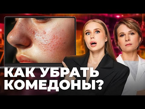 Видео: Как избавиться от рубцов и комедонов? Разбираем по фактам видео бьюти-блогеров