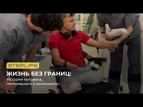 Видео: Ампутация рук и ног I История протезирования