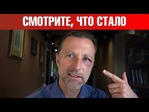 Видео: Вот до чего дошло...😲 Стресс, кортизол, преднизон.