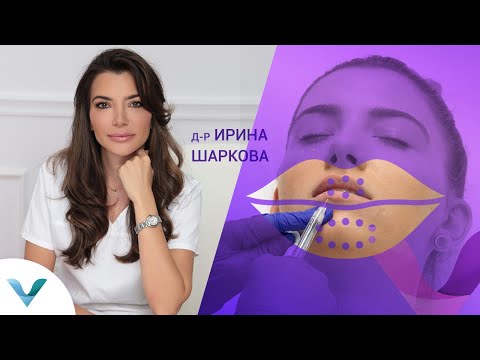 Видео: Филъри за устни - д-р Ирина Шаркова