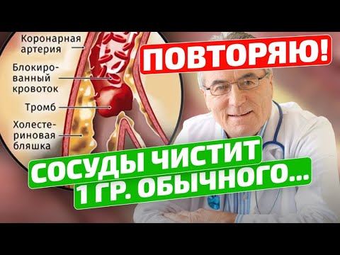 Видео: Старый флеболог: Смотрите, как я легко чищу сосуды от бляшек и тромбов! Сборник РАБОЧИХ рецептов!