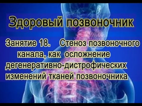 Видео: Занятие 18.   Стенозы позвоночных каналов в больном позвоночнике при ДДИ.