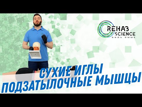 Видео: Боль в шее. Сухие иглы, подзатылочные мышцы.