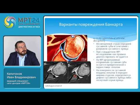 Видео: "МРТ-диагностика травм и патологий плечевого сустава", Капитонов Иван Владимирович.