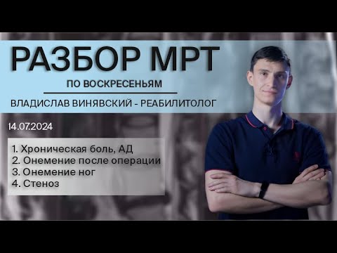 Видео: Разбор МРТ участников чата - реабилитолог Владислав Винявский (14.07)