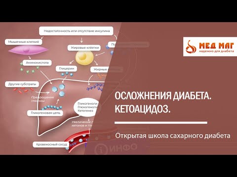 Видео: Осложнения диабета. Кетоацидоз.