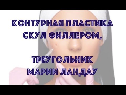 Видео: КОНТУРНАЯ ПЛАСТИКА СКУЛ ФИЛЛЕРОМ, ТРЕУГОЛЬНИК МАРИИ ЛАНДАУ