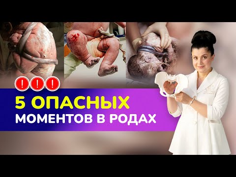 Видео: ⚠️5 опасных моментов в родах I Какие осложнения могут возникнуть во время родов?