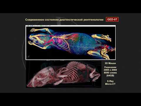 Видео: "Рентгеновское излучение как продольная ударная эфирная волна", Авшаров Е.М.