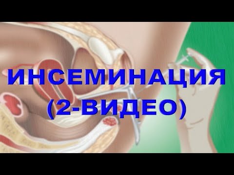 Видео: ИНСЕМИНАЦИЯ ҲАҚИДА 2-ВИДЕО