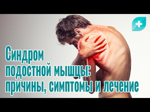 Видео: Синдром подостной мышцы: причины, симптомы и лечение