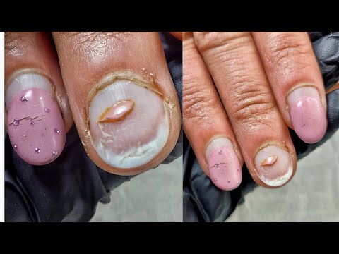 Видео: ПЛЮШКИ ВМЕСТО НОГТЕЙ 😢ГРУБАЯ КУТИКУЛА. НАРАЩИВАНИЕ БЕЗ ФОРМ. НЕЖНЫЙ ДИЗАЙН