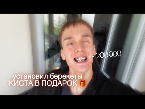 Видео: Помогите, я поставил брекеты