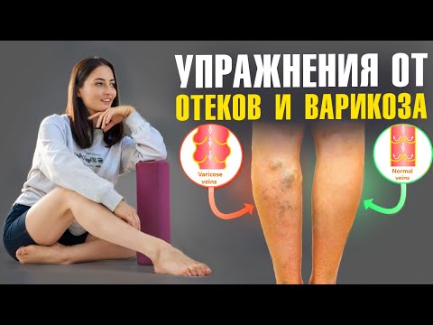 Видео: ВАРИКОЗ, ОТЕКИ и ТЯЖЕСТЬ В НОГАХ? СРОЧНО начинай делать эти простые упражнения