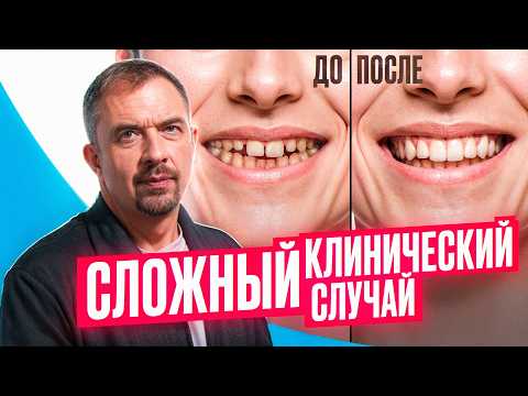 Видео: СТОМАТОЛОГ СДЕЛАЛ ХУЖЕ? Как избежать КОШМАРА при лечении зубов