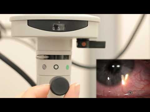 Видео: Методы работы с щелевой лампой: ретро-освещение