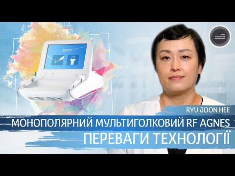 Видео: Монополярний мультиголковий RF AGNES. Переваги технології