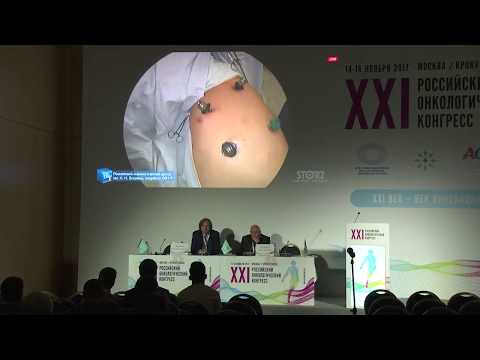 Видео: Торакоскопическая лобэктомия