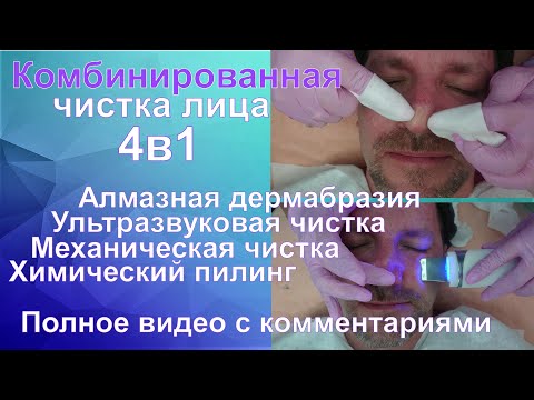 Видео: Комбинированная чистка лица/Чистка ультразвуком/Механическая чистка/Химический пилинг