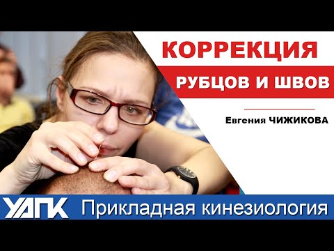 Видео: Коррекция рубцов и швов (Е.Чижикова)