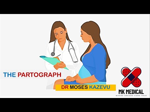 Видео: Партограмма || Как построить партограмму